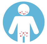 Clinical predictors of a positive MPox PCR: A framework for diagnostic stewardship